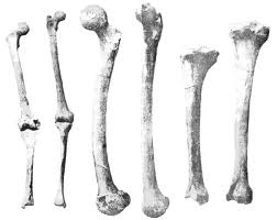 Alcohol Abuse and the Bones Alcohol Abuse and the Bones
