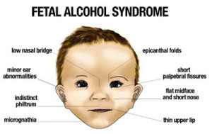 Baby Facial Features 104