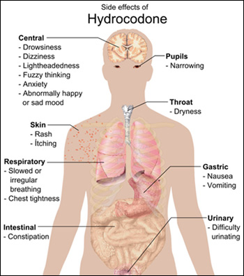 Zohydro Hydrocodone Side Effects