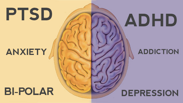 Dual Diagnosis