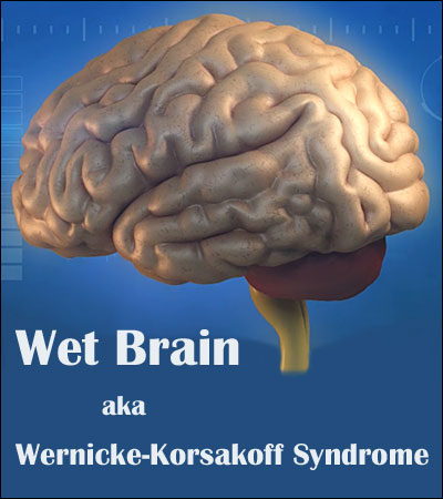 10 Facts to Understand About “Wet Brain” (Wernicke-Korsakoff Syndrome