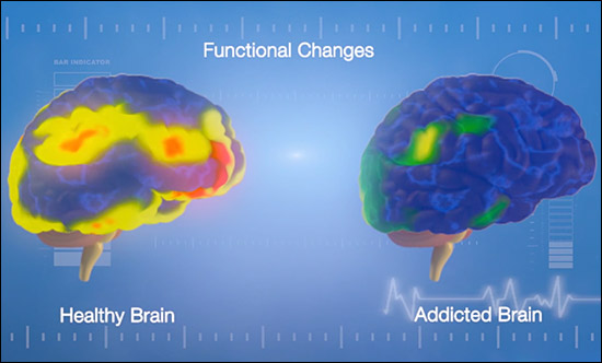 Functional Brain Changes Side