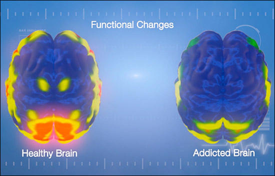 Functional Brain Changes Top