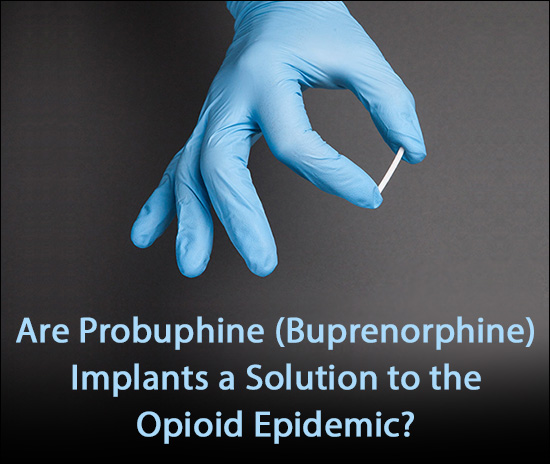 Probuphine Buprenorphine Implants