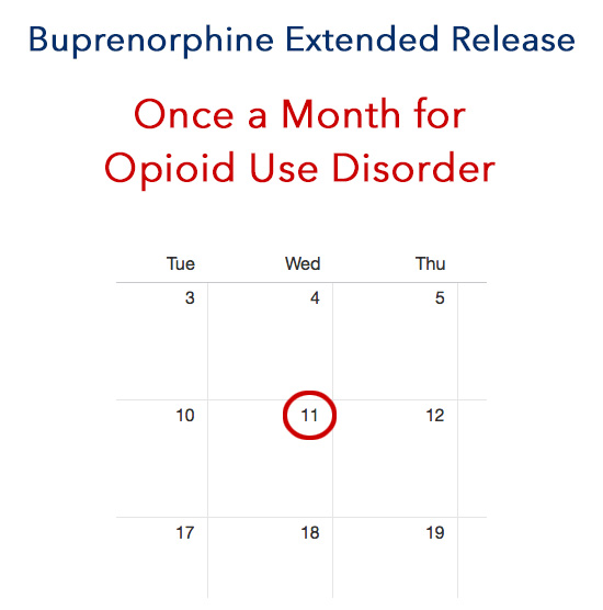 Sublocade Monthly Injection for Opioid Use Disorder