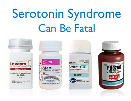 Serotonin Syndrome