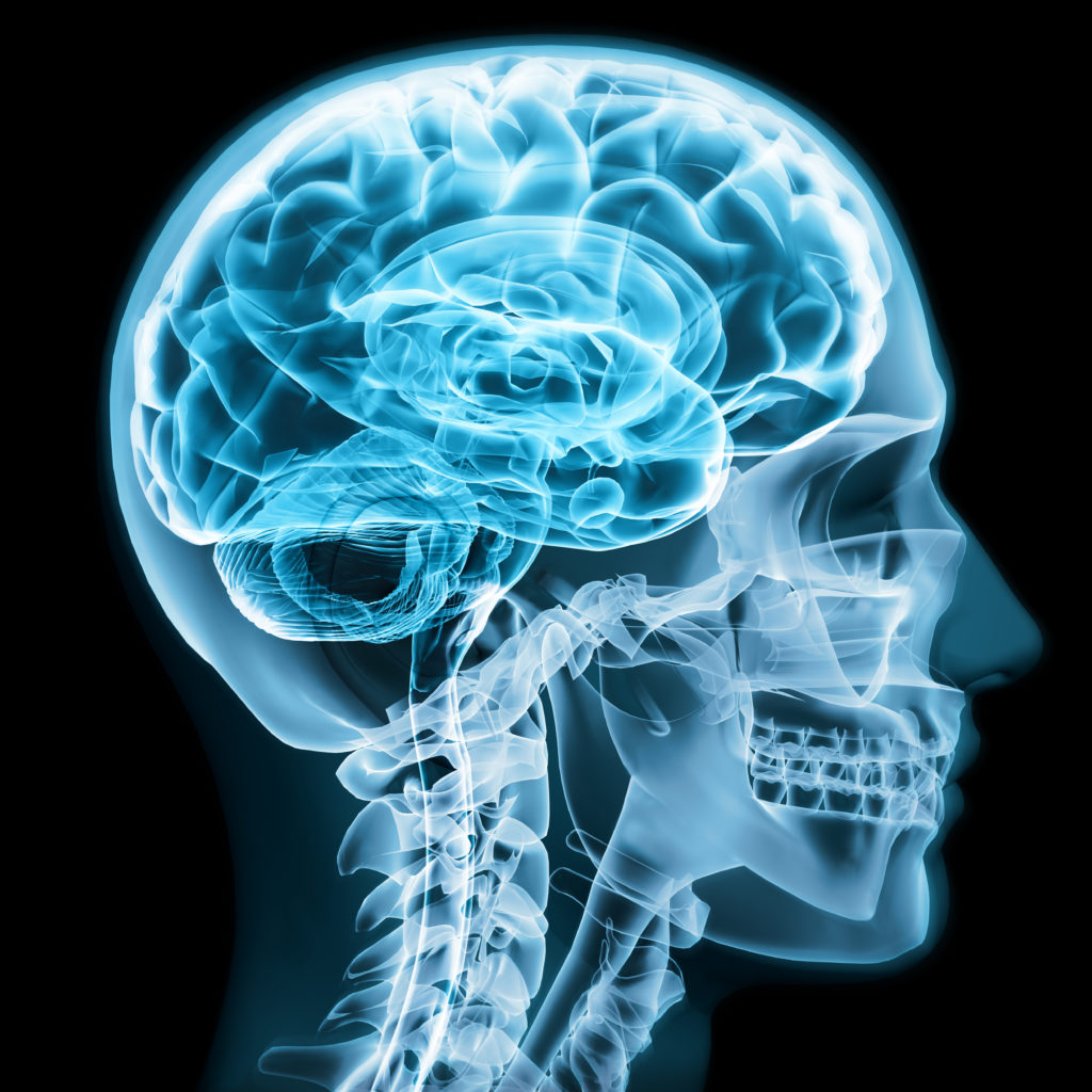 X-Ray image of brain